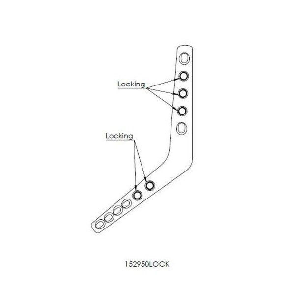 Elbow Arthrodesis Plate 3.5mm/2.7mm - Surgical SystemsArthrodesis