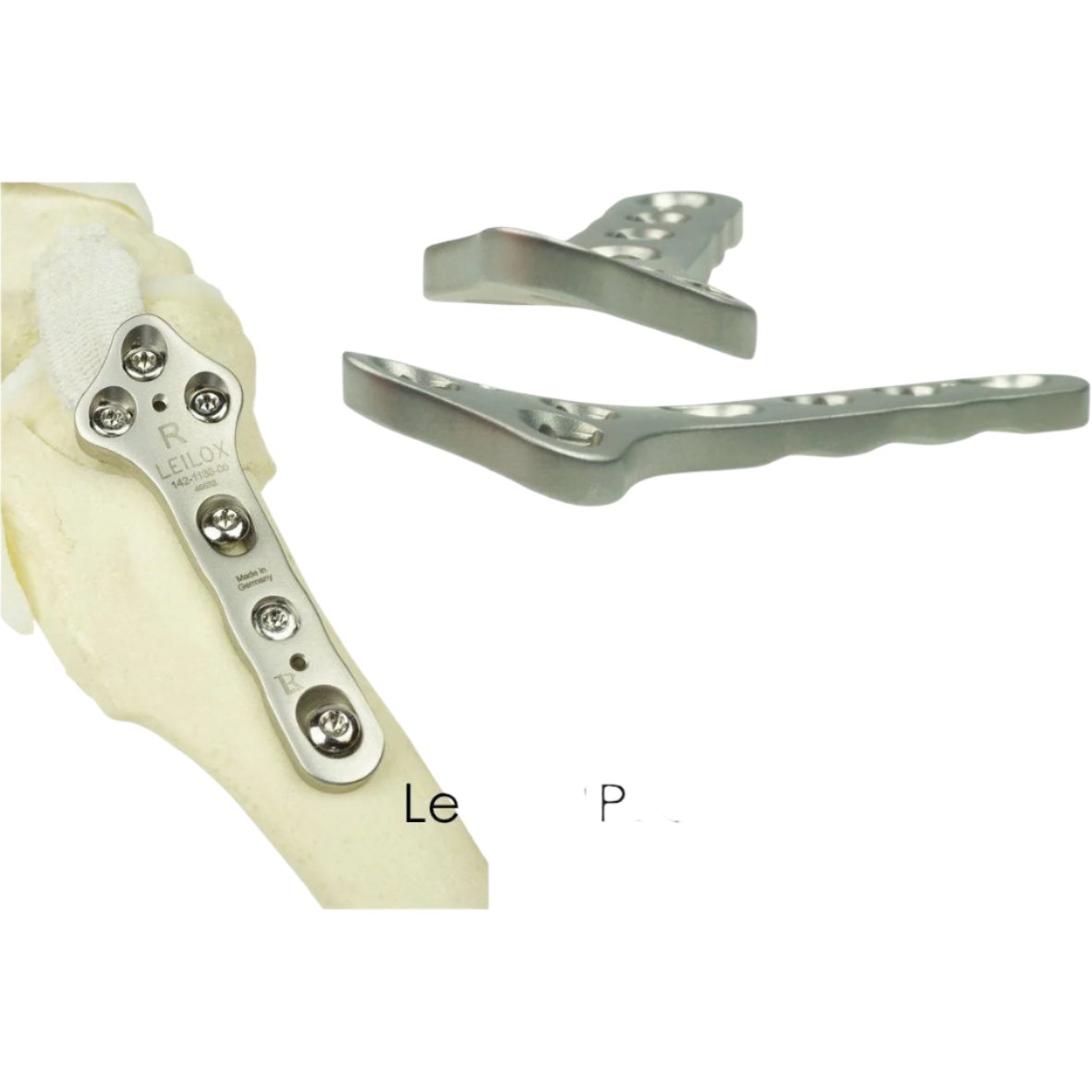 LeiLox TPLO Locking Plates Stainless Steel - Surgical Systems