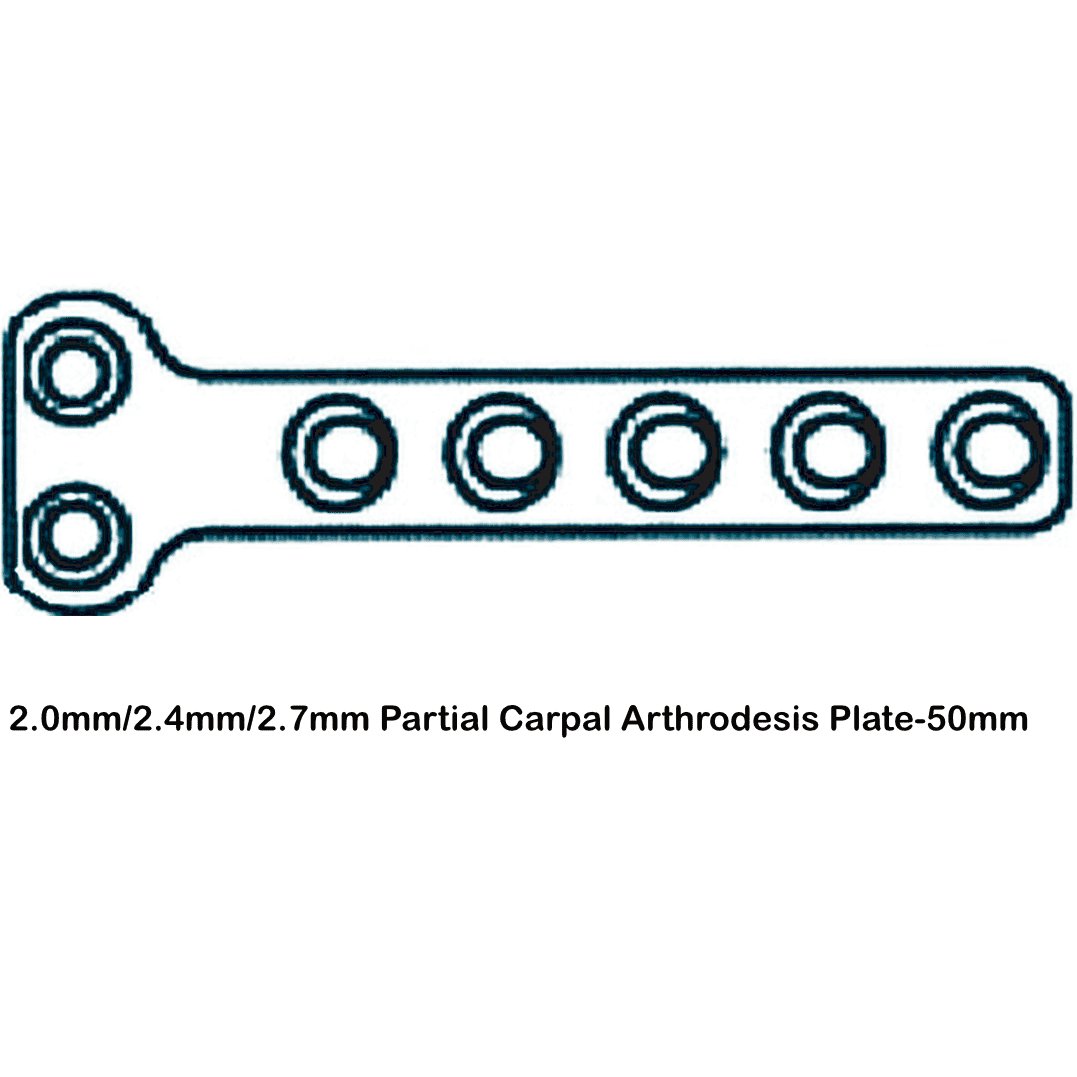 Partial Carpal Arthrodesis Plate - Surgical SystemsArthodesis