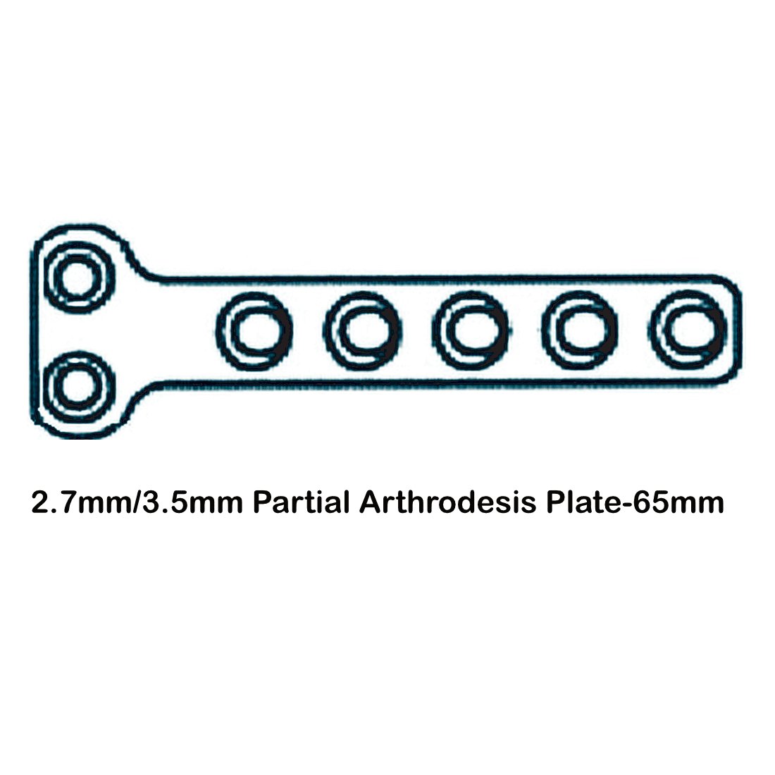 Partial Carpal Arthrodesis Plate - Surgical SystemsArthodesis