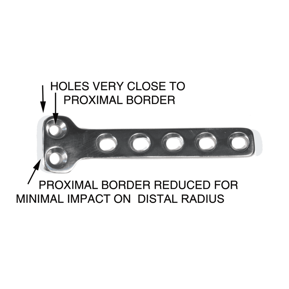 Partial Carpal Arthrodesis Plate - Surgical SystemsArthodesis
