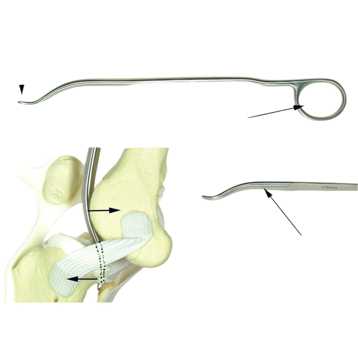 Stifle Lever for Canine Surgery – Premium Quality Tool - Surgical SystemsMeniscus Instruments