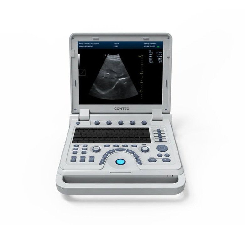 CMS600P2Plus B ultrasound ; portable withabdomenconvexprobe
