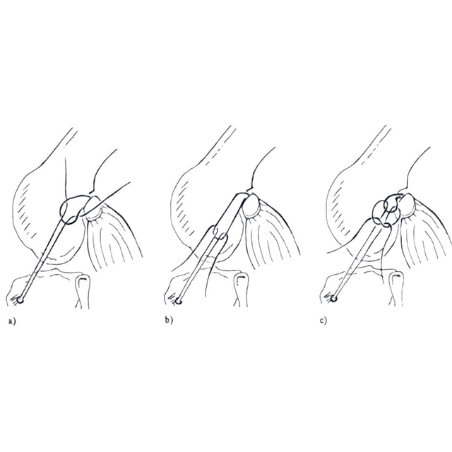 CCL Lateral Nylon Sutures Double - no Crimp - Surgical SystemsCCL Kits & Crimps