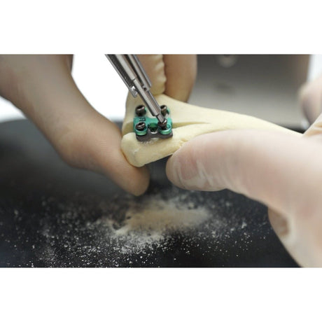 Patella Rapid Luxation Spacers - Surgical SystemsRapid Luxation Rita