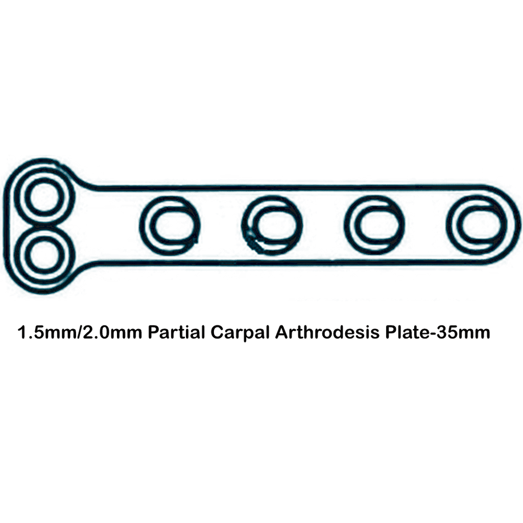 Partial Carpal Arthrodesis Plate